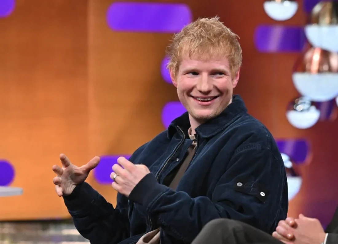 Ed Sheeran shaved head